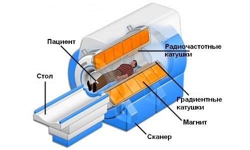 Схема проведения КТ